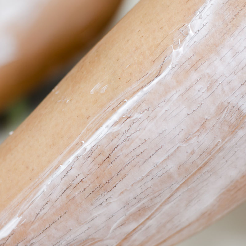 5 Things You Must Know Before Using Hair Removal Creams 5 Things You Must Know Before Using Hair Removal Creams