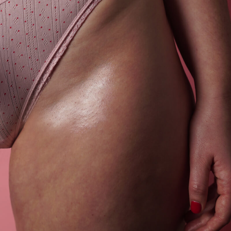 Comparing Brazilian and Bikini Hair Removal Methods Comparing Brazilian and Bikini Hair Removal Methods